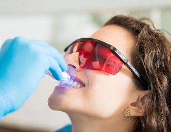 How Is Professional Dental Cleaning Better Than At-Home Whitening?