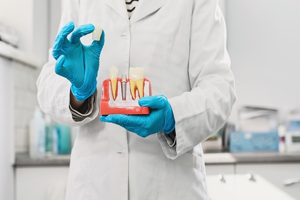 Dental Crown Materials: How To Make The Right Choice For Your Smile