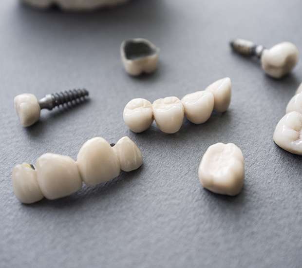 Gilbert The Difference Between Dental Implants and Mini Dental Implants