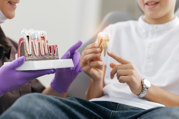 Can You Whiten Tooth Implants?